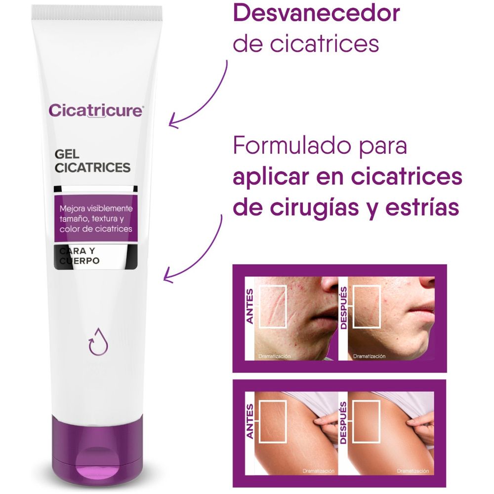 pack 04 cicatricure gel cicatrices estrias 30g c/u