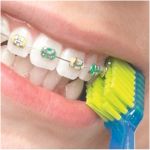 Curaprox Cepillo Dental CS 5460 Ortodoncia 1 unidad - Imagen 7